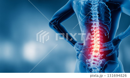 人体のイメージ 　腰痛 131694826