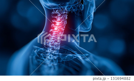人体イメージ　首、肩の痛み 131694882