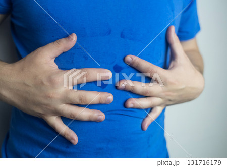 A man suffers from palmar hyperhidrosis. He wipes his sweaty palms due to excessive sweating. Treatment of hyperhidrosis with botulinum toxin injection into the hand. 131716179