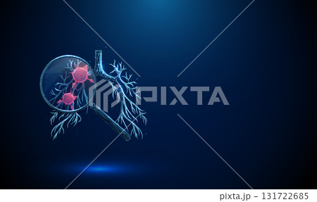 3d human lungs under a magnifying glass with a red tumor inside Pulmonary cancer diagnostics, oncology research, pathology investigation, biomedical study concept. 131722685