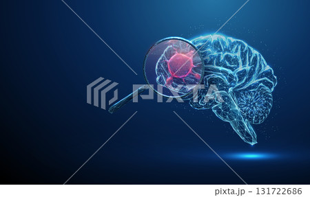 Human brain under magnifying glass with red tumor inside Brain cancer diagnostics, neurological disease detection, pathology investigation, biomedical study concept. Human brain under magnifying glass with red tumor inside Brain cancer diagnostics, neurological disease detection, pathology investigation, biomedical study concept. 131722686