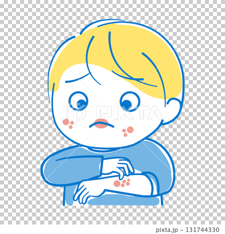 Boy with itchy skin due to allergies 131744330