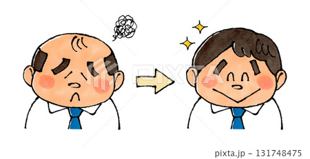 薄毛からカツラにする男性 131748475