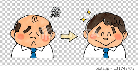 薄毛からカツラにする男性 131748475