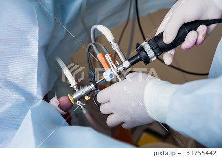 Process of urological surgery operation using laparoscopic equipment. Process of urological surgery operation using laparoscopic equipment. 131755442
