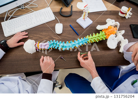 Doctor show polyaxial screw on the spine model. Spine fixation systems 131756204