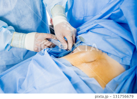 Arthroscope surgery. Orthopedic surgeons in teamwork in the operating room 131756679