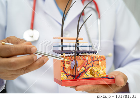 Hair transplant, Asian dermatologist doctor holding skin structure anatomy model for treatment in hospital. 131781533
