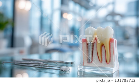 Anatomical Tooth Model with Dental Implant in Modern Clinic Setting 131788712