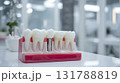 Dental Model Showing Tooth Decay and Implant in Modern Office Setting 131788819