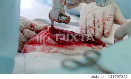 Surgical team performing intricate medical procedure, wielding specialized instruments over blood stained operating field, demonstrating critical healthcare expertise Surgical team performing intricate medical procedure, wielding specialized instruments over blood stained operating field, demonstrating critical healthcare expertise 131797221