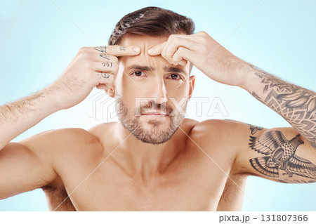 Face, portrait and skin of man with acne or pimple problem with dermatology for self care studio. Frustrated or angry person with hands to press spot for skincare facial wellness on blue background Face, portrait and skin of man with acne or pimple problem with dermatology for self care studio. Frustrated or angry person with hands to press spot for skincare facial wellness on blue background 131807366