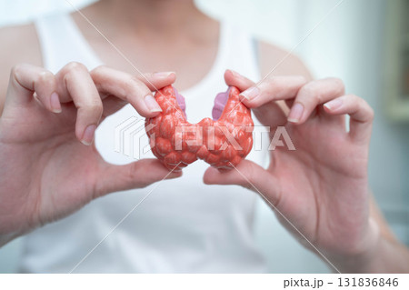 Hyperthyroidism, Overactive Thyroid, Thyroid Lymphoma, Asian woman with thyroid gland human anatomy model. Hyperthyroidism, Overactive Thyroid, Thyroid Lymphoma, Asian woman with thyroid gland human anatomy model. 131836846