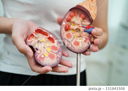 Chronic kidney disease, Asian woman with model for treatment urinary system, urology, Estimated glomerular filtration rate eGFR. Chronic kidney disease, Asian woman with model for treatment urinary system, urology, Estimated glomerular filtration rate eGFR. 131843308
