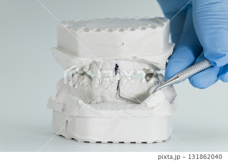 Dental plaster bite model examined with tool Dental plaster bite model examined with tool 131862040