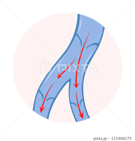 Varicose veins. Blue blood vessel visible through the skin. Vascular disease diagnostic and treatment. Venous insufficiency medical 131900275