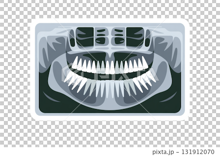 Dental X-ray image illustration (panoramic radiograph) 131912070