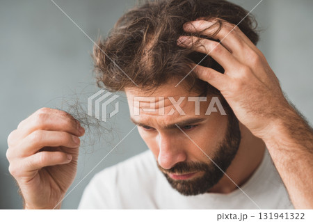 Worried man holding fallen hair in hands 131941322