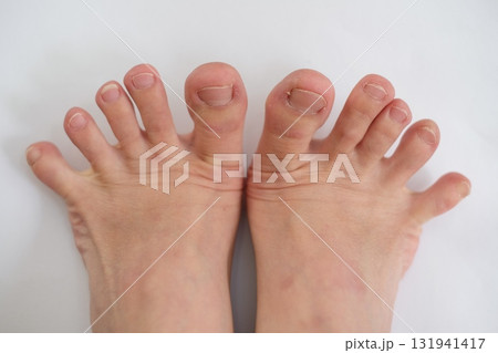 40代女性の両足 40代女性の両足 131941417
