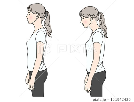 正しい姿勢で立つ女性と猫背の女性のイラスト 上半身横向き カラー 131942426