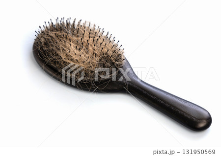 Lots of hair loss on hair brushes. Hair loss concept Lots of hair loss on hair brushes. Hair loss concept 131950569
