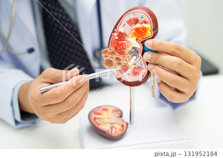 Kidney disease, Chronic kidney disease ckd, Doctor hold human model to treat and study in hospital. 131952184