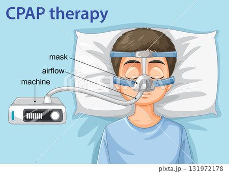Child Using CPAP Machine for Sleep Apnea Therapy 131972178