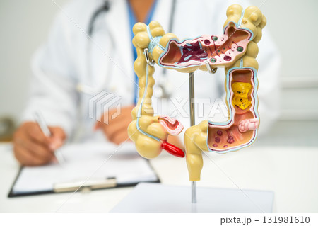 Intestine, appendix and digestive system, doctor holding anatomy model for study diagnosis and treatment in hospital. Intestine, appendix and digestive system, doctor holding anatomy model for study diagnosis and treatment in hospital. 131981610