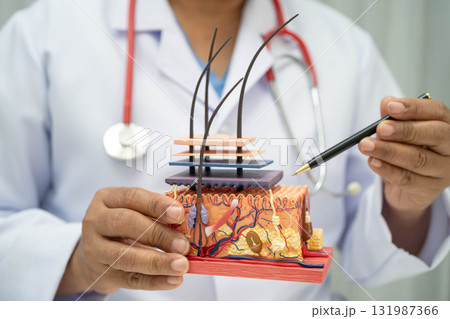 Hair transplant, Asian dermatologist doctor holding skin structure anatomy model for treatment in hospital. Hair transplant, Asian dermatologist doctor holding skin structure anatomy model for treatment in hospital. 131987366