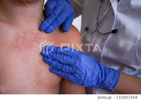 The doctor is evaluating the child's skin for symptoms of contagious diseases. 132001568