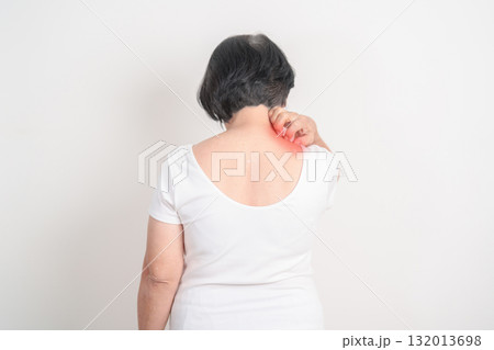 Elderly woman itching Neck and body scratching for Skin Allergy from insect bite and food dermatitis. Dermatology, Leprosy day, Systemic lupus erythematosus, Psoriasis, Urticaria and rash Eczema 132013698