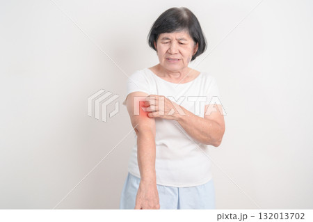 Elderly woman itching arm and body scratching for Skin Allergy from insect bite and food dermatitis. Dermatology, Leprosy day, Systemic lupus erythematosus, Psoriasis, Urticaria and rash Eczema 132013702