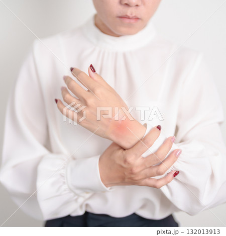 Woman having wrist pain with Medicated pain relief patch plaster for Carpal Tunnel Syndrome, Wrist Tendinitis ache, De Quervain s tenosynovitis, ergonomic, Hand Osteoarthritis and Office syndrome Woman having wrist pain with Medicated pain relief patch plaster for Carpal Tunnel Syndrome, Wrist Tendinitis ache, De Quervain s tenosynovitis, ergonomic, Hand Osteoarthritis and Office syndrome 132013913