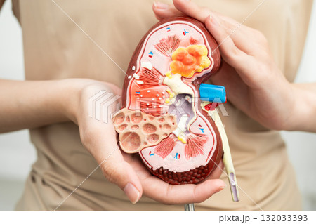 Chronic kidney disease, Asian woman with model for treatment urinary system, urology, Estimated glomerular filtration rate eGFR. 132033393