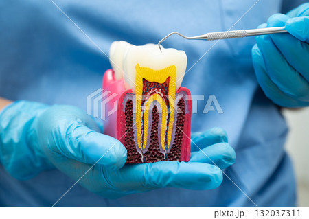 Dentist holding dental implant, artificial tooth roots into jaw, root canal of dental treatment, gum disease, teeth model for dentist. Dentist holding dental implant, artificial tooth roots into jaw, root canal of dental treatment, gum disease, teeth model for dentist. 132037311