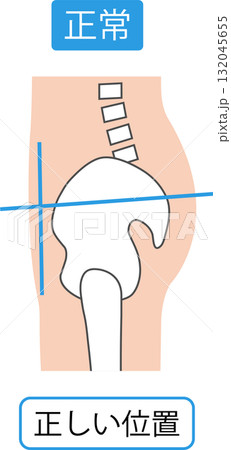 正しい姿勢　骨盤 132045655