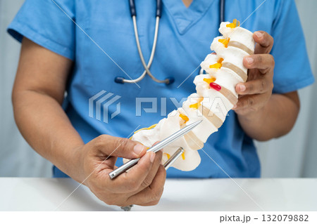 Asian doctor holding spinal nerve and bone model, Lumbar spine displaced herniated disc fragment for treatment medical in the orthopedic department. Asian doctor holding spinal nerve and bone model, Lumbar spine displaced herniated disc fragment for treatment medical in the orthopedic department. 132079882