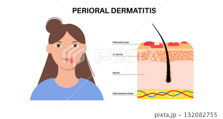 Dermatitis skin disease Dermatitis skin disease 132082755