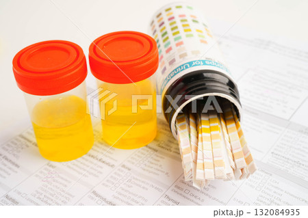 Urinalysis, urine cup with reagent strip pH paper test and comparison chart in laboratory. Urinalysis, urine cup with reagent strip pH paper test and comparison chart in laboratory. 132084935