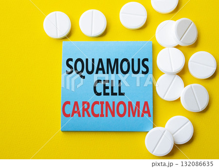 Squamous Cell Carcinoma symbol. Concept words Squamous Cell Carcinoma on blue note. Beautiful yellow background with pills. Healthcare and Squamous Cell Carcinoma concept. Copy space. Squamous Cell Carcinoma symbol. Concept words Squamous Cell Carcinoma on blue note. Beautiful yellow background with pills. Healthcare and Squamous Cell Carcinoma concept. Copy space. 132086635