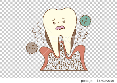 牙周病惡化並引起疼痛的圖示 132089036