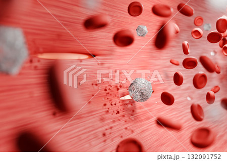 高血糖が血管を傷つける糖尿病の合併症 3Dメディカルイラスト 132091752