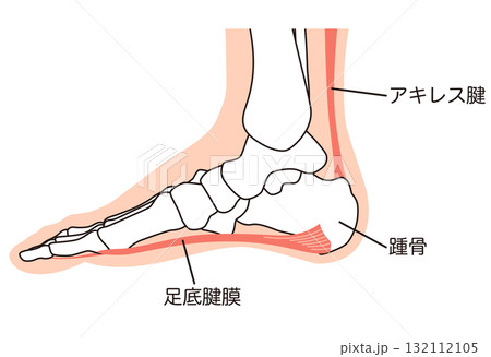 足底筋膜　足底腱膜　足底筋膜炎　足の筋肉 132112105