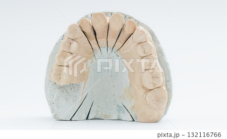 Sectioned dental cast of upper teeth arch 132116766