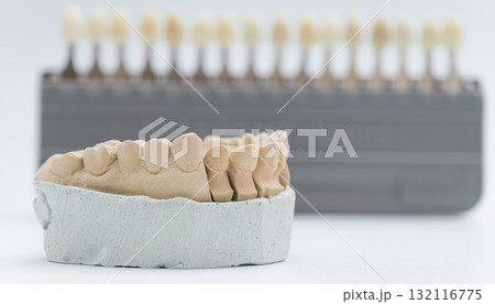 Dental model with tooth shade guide in background 132116775