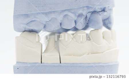 Dental crown preparation model with occlusion check 132116793