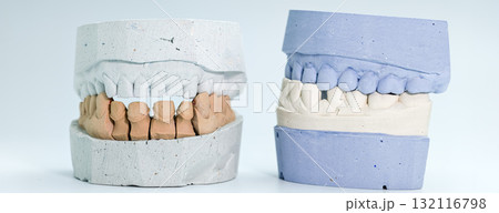 Side-by-side dental cast models for oral restoration 132116798