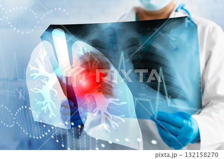 Doctor examines lung x-ray with highlighted area and heart monitor in healthcare setting Doctor examines lung x-ray with highlighted area and heart monitor in healthcare setting 132158270