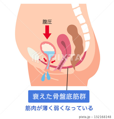 衰えた骨盤底筋群　骨盤底筋 132168148