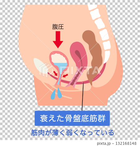 骨盆底肌肉無力 骨盆底肌肉 132168148
